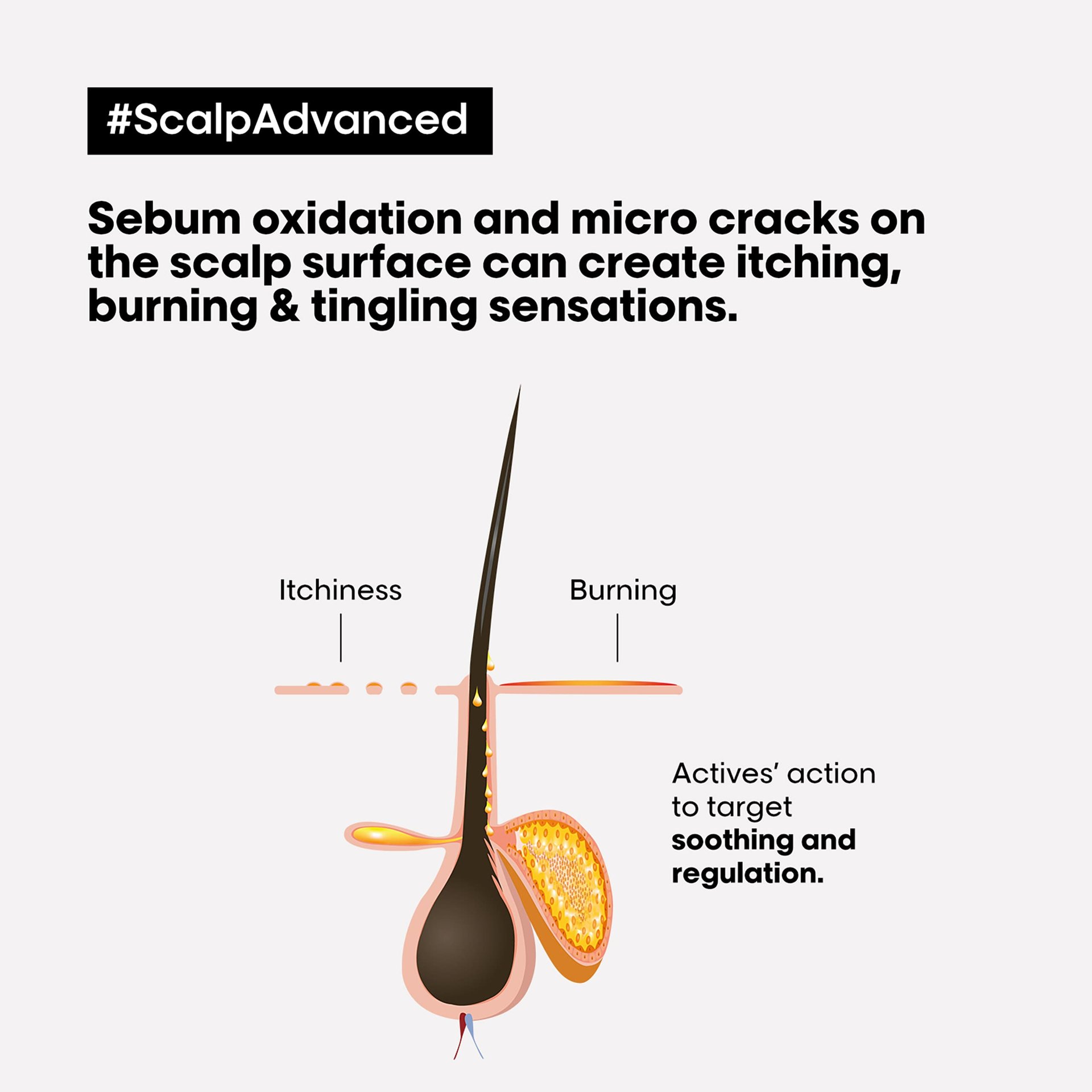 scalp-advanced-tratamiento-calmante-intenso-antimolestias8